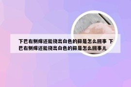 下巴右侧痒还能挠出白色的藓是怎么回事 下巴右侧痒还能挠出白色的藓是怎么回事儿