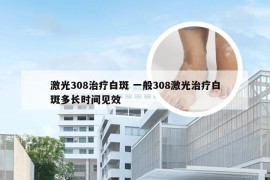 激光308治疗白斑 一般308激光治疗白斑多长时间见效