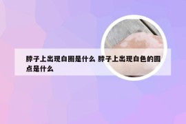 脖子上出现白圈是什么 脖子上出现白色的圆点是什么