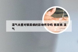 湿气太重对银屑病的影响怀孕吗 银屑病 湿气