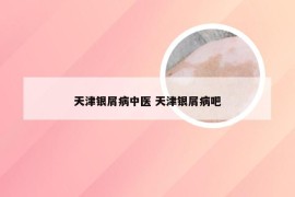 天津银屑病中医 天津银屑病吧