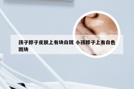 孩子脖子皮肤上有块白斑 小孩脖子上有白色斑块