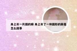 身上长一片圆的癣 身上长了一块圆形的藓是怎么回事