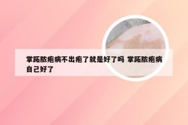 掌跖脓疱病不出疱了就是好了吗 掌跖脓疱病自己好了