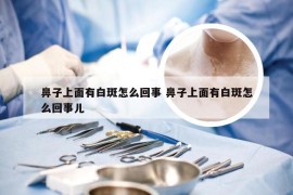 鼻子上面有白斑怎么回事 鼻子上面有白斑怎么回事儿