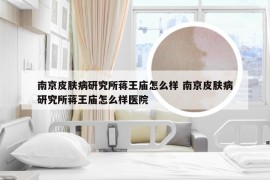 南京皮肤病研究所蒋王庙怎么样 南京皮肤病研究所蒋王庙怎么样医院
