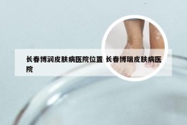 长春博润皮肤病医院位置 长春博瑞皮肤病医院