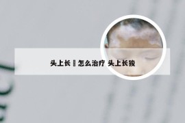 头上长廯怎么治疗 头上长狻