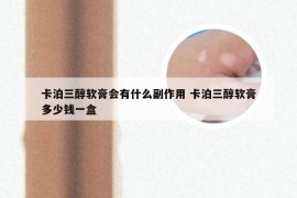 卡泊三醇软膏会有什么副作用 卡泊三醇软膏多少钱一盒