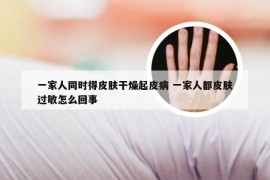 一家人同时得皮肤干燥起皮病 一家人都皮肤过敏怎么回事