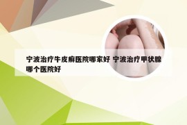 宁波治疗牛皮癣医院哪家好 宁波治疗甲状腺哪个医院好