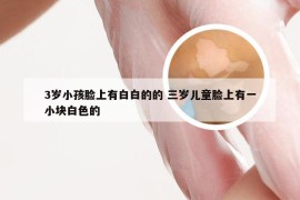 3岁小孩脸上有白白的的 三岁儿童脸上有一小块白色的