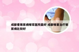 成都看银屑病哪家医院最好 成都哪里治疗银屑病比较好