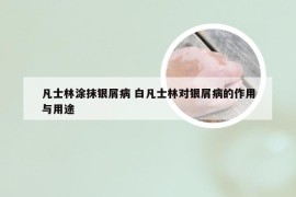 凡士林涂抹银屑病 白凡士林对银屑病的作用与用途