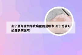 南宁最专业的牛皮癣医院是哪家 南宁比较好的皮肤病医院