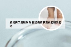 被烫伤了皮肤发白 被烫伤皮肤发白起皱没起泡