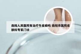 南阳人民医院有治疗牛皮癣吗 南阳市医院皮肤科专家门诊