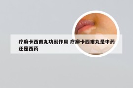 疗癣卡西甫丸功副作用 疗癣卡西甫丸是中药还是西药