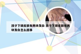 孩子下颌皮肤有两块发白 孩子下颌皮肤有两块发白怎么回事