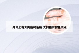 身体上有大拇指褐色癣 大拇指有棕色斑点