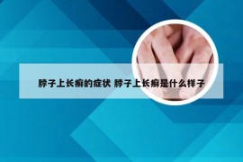 脖子上长癣的症状 脖子上长癣是什么样子