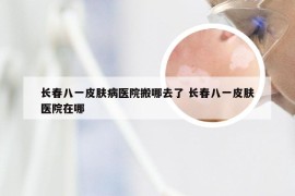 长春八一皮肤病医院搬哪去了 长春八一皮肤医院在哪