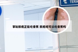 掌趾脓疱正能吃香蕉 脓疱疮可以吃香蕉吗