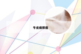 牛皮癣厚度