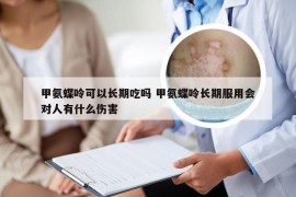 甲氨蝶呤可以长期吃吗 甲氨蝶呤长期服用会对人有什么伤害