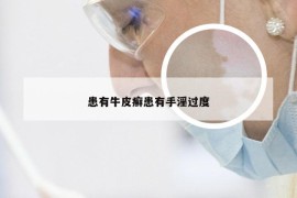 患有牛皮癣患有手淫过度