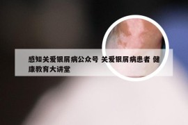 感知关爱银屑病公众号 关爱银屑病患者 健康教育大讲堂