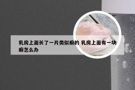 乳房上面长了一片类似癣的 乳房上面有一块癣怎么办