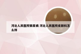 河北人民医院银屑病 河北人民医院皮肤科怎么样