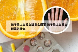 孩子脸上出现白斑怎么回事 孩子脸上出现白斑是为什么