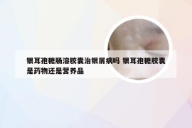 银耳孢糖肠溶胶囊治银屑病吗 银耳孢糖胶囊是药物还是营养品