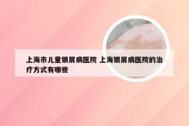 上海市儿童银屑病医院 上海银屑病医院的治疗方式有哪些