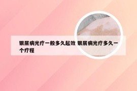 银屑病光疗一般多久起效 银屑病光疗多久一个疗程