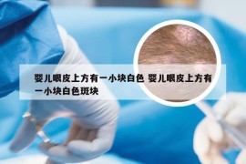 婴儿眼皮上方有一小块白色 婴儿眼皮上方有一小块白色斑块