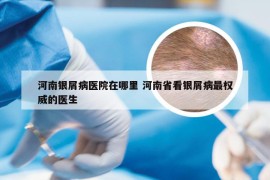 河南银屑病医院在哪里 河南省看银屑病最权威的医生