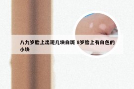 八九岁脸上出现几块白斑 8岁脸上有白色的小块