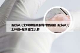 百肤邦凡士林橄榄尿素霜对银屑病 百多邦凡士林维e尿素霜怎么样
