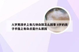 八岁男孩手上有几块白斑怎么回事 8岁的孩子手指上有白点是什么原因
