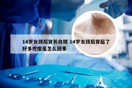 14岁女孩后背长白斑 14岁女孩后背起了好多疙瘩是怎么回事