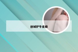 创城铲牛皮癣