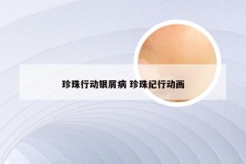 珍珠行动银屑病 珍珠纪行动画