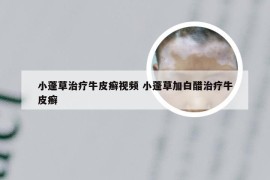 小蓬草治疗牛皮癣视频 小蓬草加白醋治疗牛皮癣