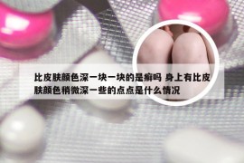 比皮肤颜色深一块一块的是癣吗 身上有比皮肤颜色稍微深一些的点点是什么情况