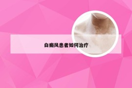 白癜风患者如何治疗