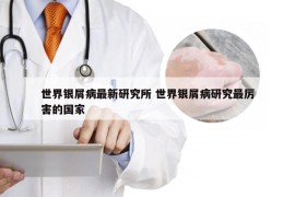 世界银屑病最新研究所 世界银屑病研究最厉害的国家