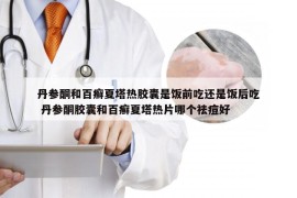 丹参酮和百癣夏塔热胶囊是饭前吃还是饭后吃 丹参酮胶囊和百癣夏塔热片哪个祛痘好